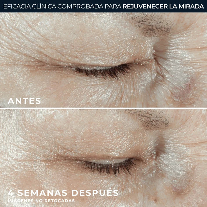 RoC® HYDRA+ CONTORNO DE OJOS 15ML